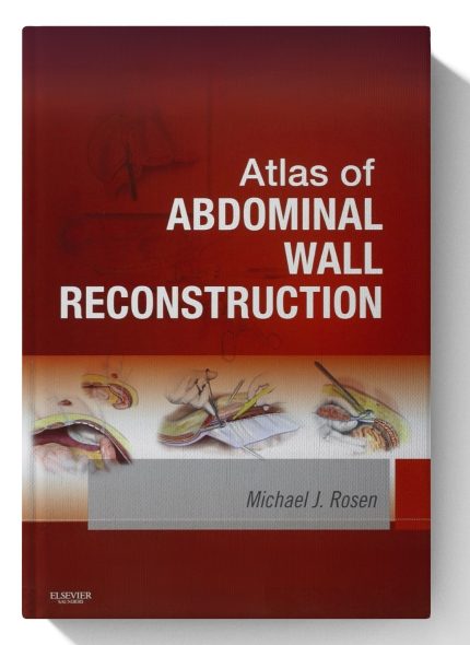 Atlas of Abdominal Wall Reconstruction: Expert Consult - Online (Digital Download) • G