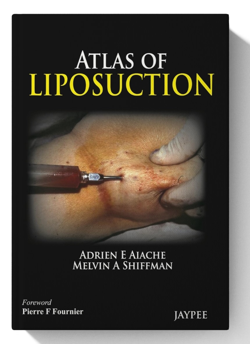 Atlas of Liposuction (Digital Download) • I