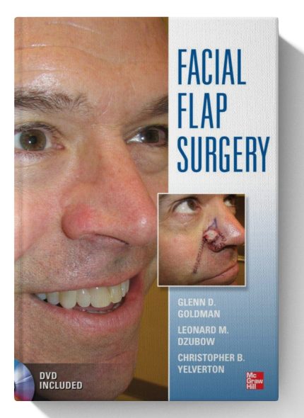 Facial Flaps Surgery (Digital Download) • I