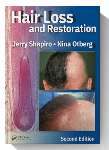 Hair Loss and Restoration (Digital Download) • C