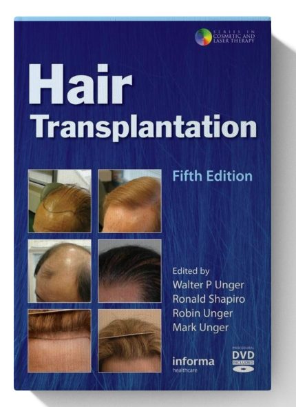 Hair Transplantation (Digital Download) • A