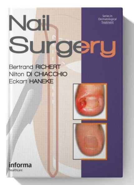Nail Surgery (Series in Dermatological Treatment) (Digital Download) • C