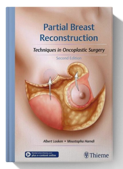 Partial Breast Reconstruction: Techniques in Oncoplastic Surgery (Digital Download) • I