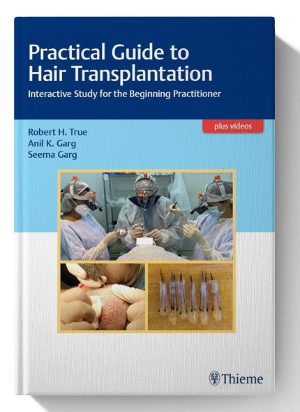 Practical Guide to Hair Transplantation: Interactive Study for the Beginning Practitioner (Digital Download) • C