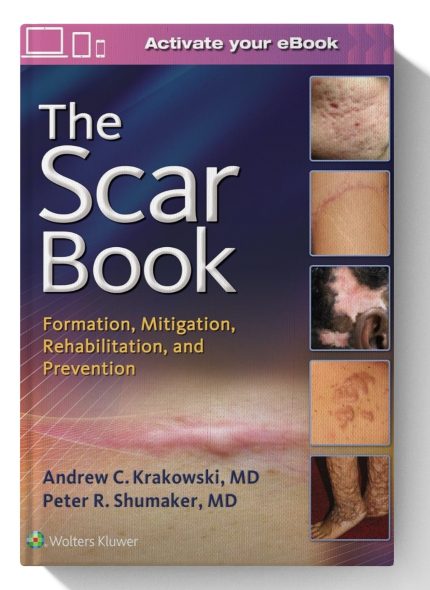 The Scar Book: Formation, Mitigation, Rehabilitation and Prevention (Digital Download) • C