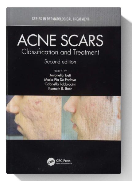Acne Scars: Classification and Treatment, Second Edition (Series in Dermatological Treatment) (Digital Download) • C
