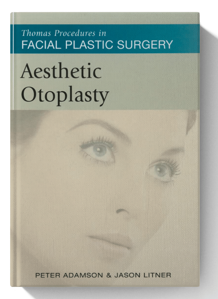 Aesthetic Otoplasty (Thomas Procedures in Facial Plastic Surgery) (Digital Download) • A