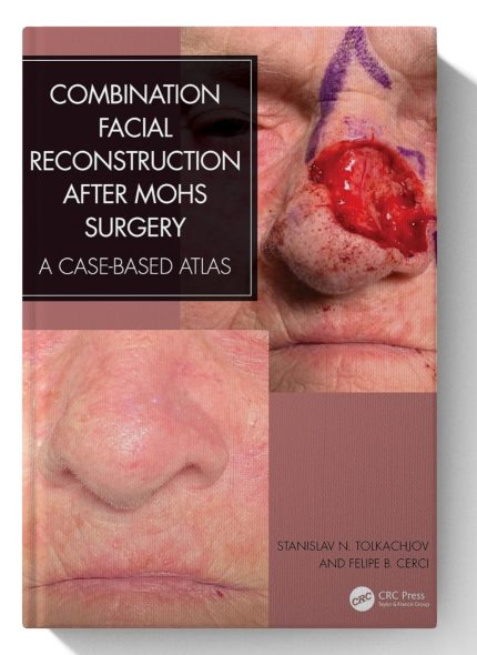 Combination Facial Reconstruction after Mohs Surgery: A Case Based Atlas (Digital Download) • I