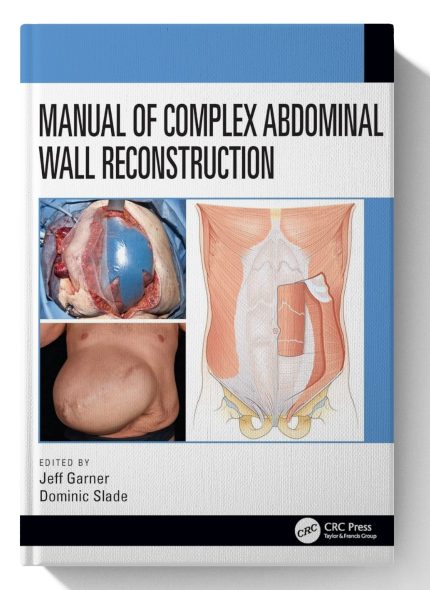 Manual of Complex Abdominal Wall Reconstruction (Digital Download) • G