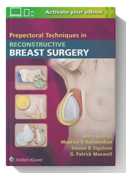 Prepectoral Techniques in Reconstructive Breast Surgery (Digital Download) • I