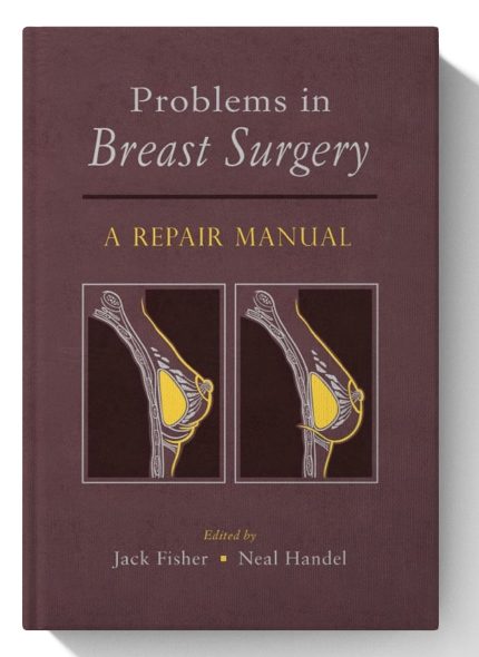 Problems in Breast Surgery: A Repair Manual (Digital Download) • I