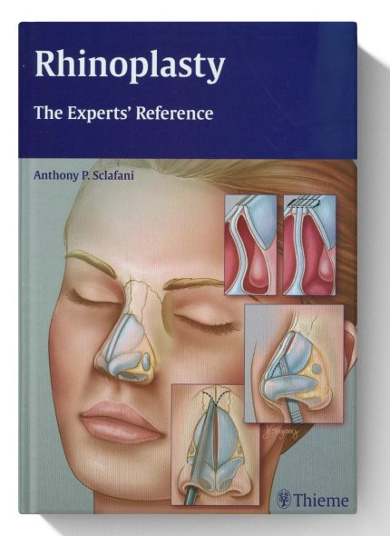 Rhinoplasty: The Experts' Reference (Digital Download) • I