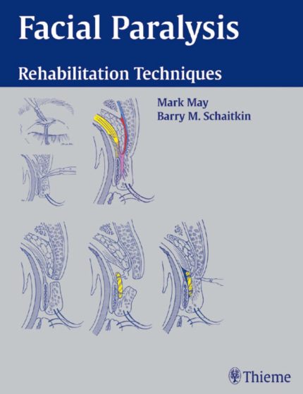 Facial Paralysis: Rehabilitation Techniques