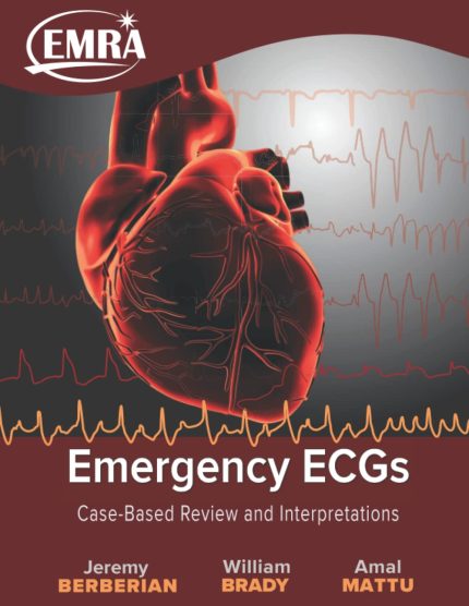 Emergency ECGs: Case-Based Review and Interpretations (Digital Download) • D