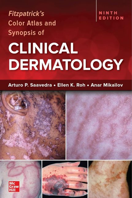 Fitzpatrick's Color Atlas and Synopsis of Clinical Dermatology, Ninth Edition (Digital Download) • C