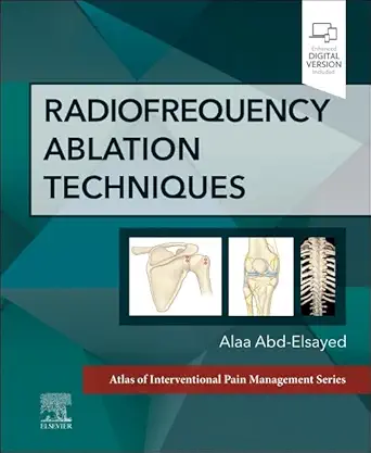 Radiofrequency Ablation Techniques: A Volume in the Atlas of Interventional Techniques Series (Atlas of Interventional Pain Management) (Digital Download) • D