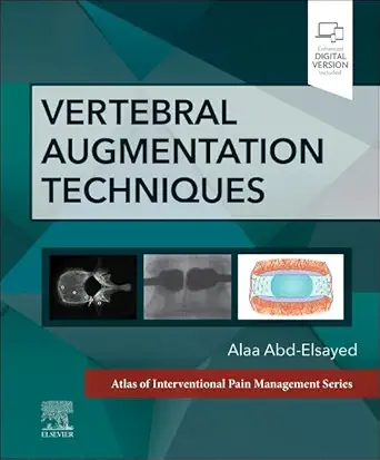 Vertebral Augmentation Techniques (Atlas of Interventional Pain Management) (Digital Download) • D