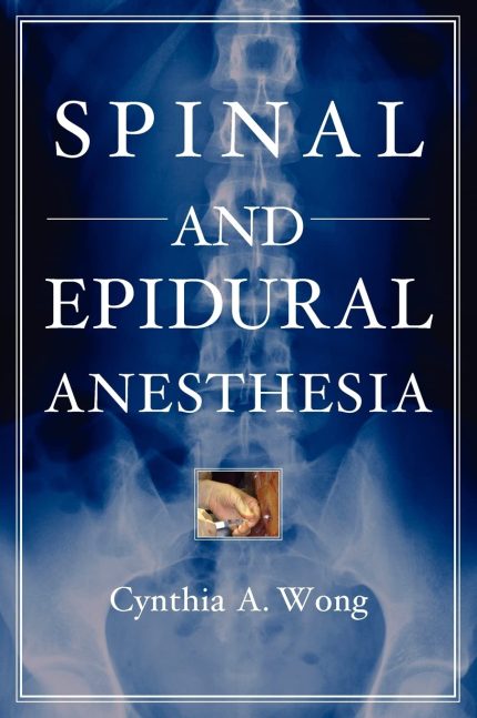 Spinal and Epidural Anesthesia (Digital Download) • B