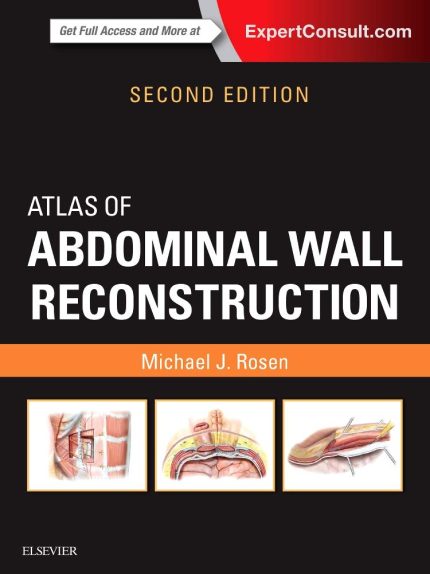 Atlas of Abdominal Wall Reconstruction: Expert Consult (Digital Download) • G