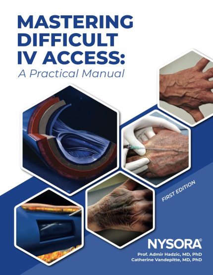 Mastering Difficult IV Access - a Practical Manual: First Edition (Digital Download) • B