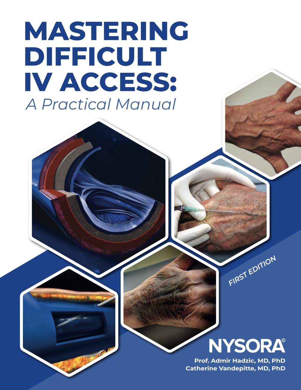 Mastering Difficult IV Access - a Practical Manual: First Edition (Digital Download) • B
