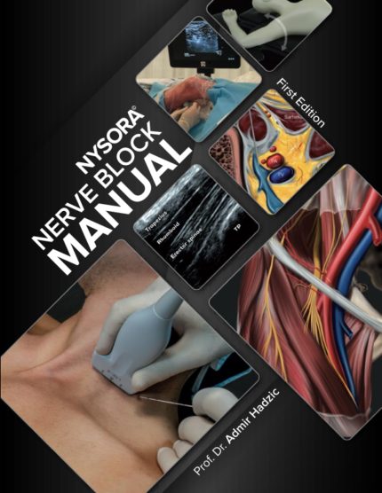 NYSORA Nerve Block Manual: First Edition (Digital Download) • B