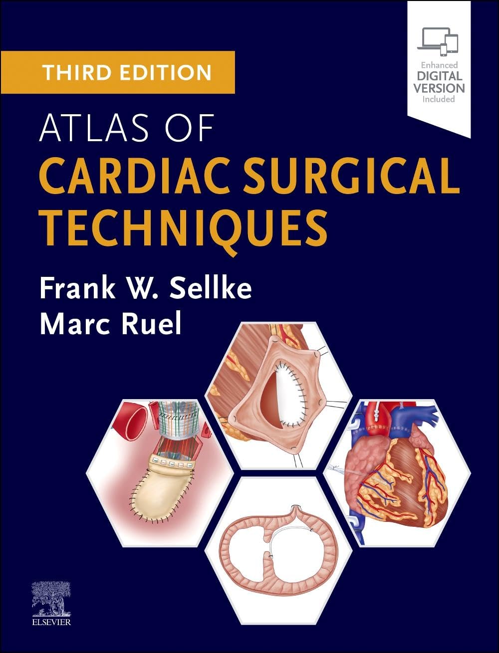 Atlas of Cardiac Surgical Techniques (Digital Download) • G