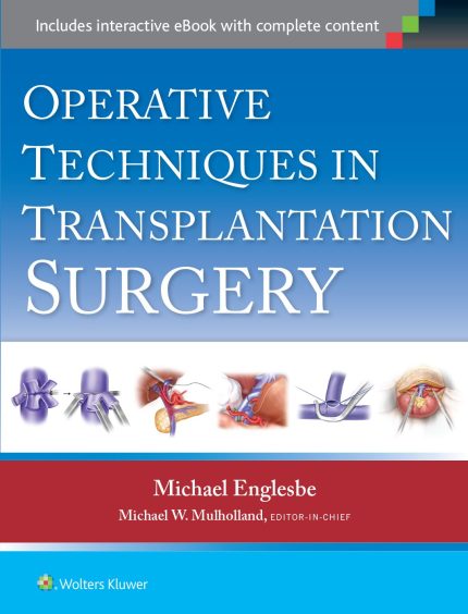 Operative Techniques in Transplantation Surgery (Digital Download) • G