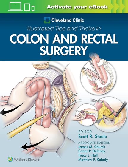 Cleveland Clinic Illustrated Tips and Tricks in Colon and Rectal Surgery (Digital Download) • G