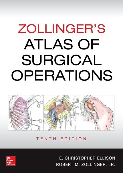 Zollinger's Atlas of Surgical Operations, 10th edition (Digital Download) • G
