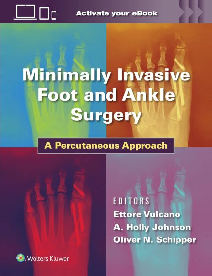 Minimally Invasive Foot and Ankle Surgery: A Percutaneous Approach (Digital Download) • G
