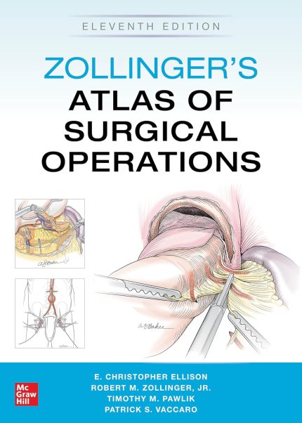 Zollinger's Atlas of Surgical Operations, Eleventh Edition (Digital Download) • G