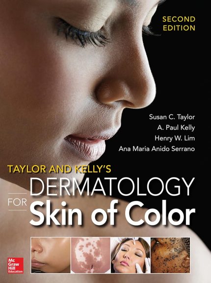 Taylor and Kelly's Dermatology for Skin of Color 2/E (Digital Download) • C