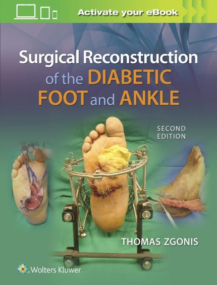 Surgical Reconstruction of the Diabetic Foot and Ankle (Digital Download) • I