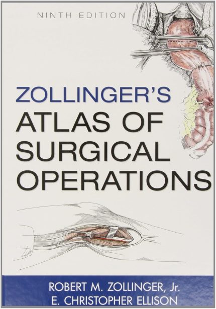 Zollinger's Atlas of Surgical Operations, 9th Edition (Digital Download) • G