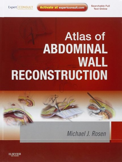 Atlas of Abdominal Wall Reconstruction: Expert Consult (Digital Download) • G