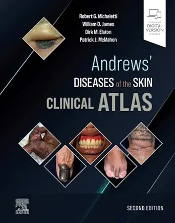 Andrews' Diseases of the Skin Clinical Atlas (Digital Download) • A