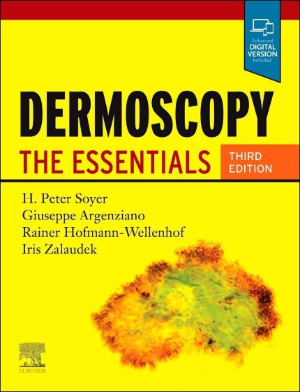 Dermoscopy: The Essentials (Digital Download) • A