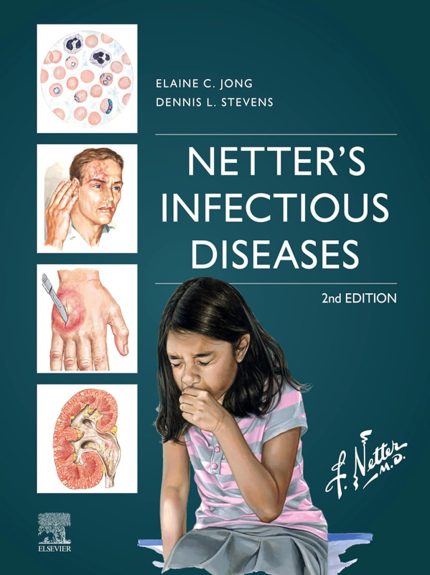 Netter's Infectious Diseases - E-Book (Digital Download) • H