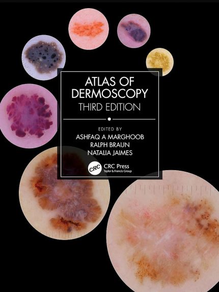 Atlas of Dermoscopy: Third Edition (Digital Download) • C