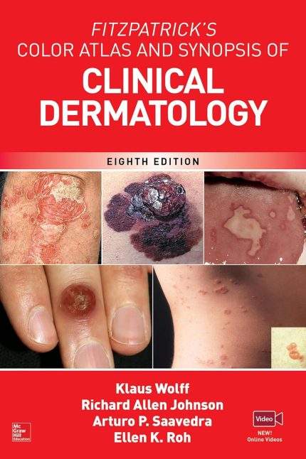 Fitzpatrick's Color Atlas AND SYNOPSIS OF CLINICAL DERMATOLOGY, 8th Ed (Digital Download) • C