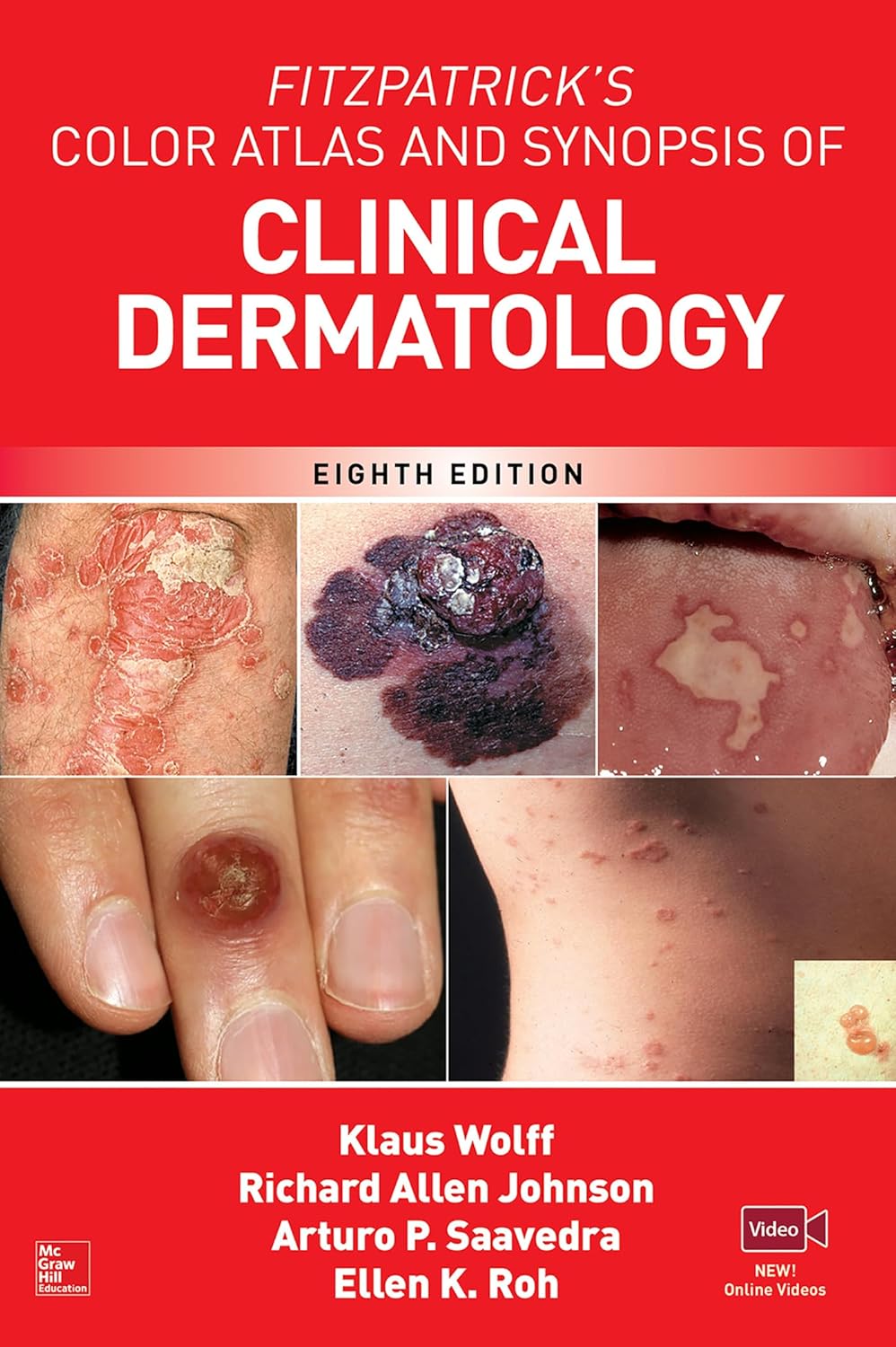 Fitzpatrick's Color Atlas AND SYNOPSIS OF CLINICAL DERMATOLOGY, 8th Ed (Digital Download) • C