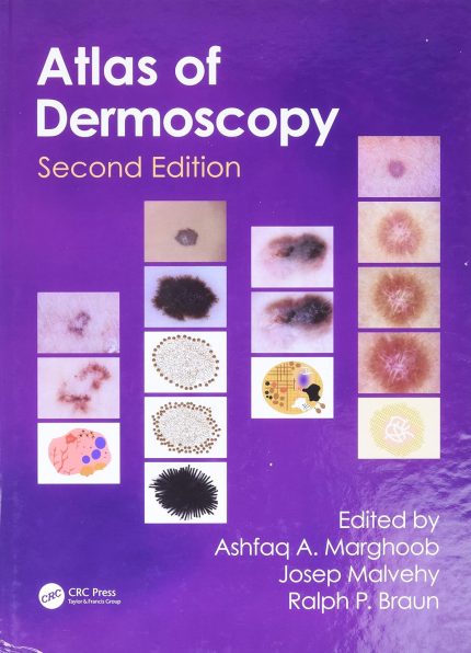 An Atlas of Dermoscopy (Digital Download) • A