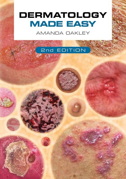 Dermatology Made Easy, second edition (Digital Download) • C