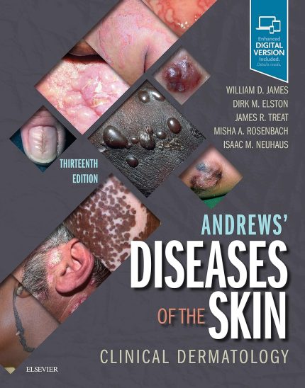 Andrews' Diseases of the Skin: Clinical Dermatology (Digital Download) • C