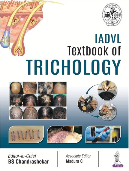 IADVL Textbook of Trichology (Digital Download) • A