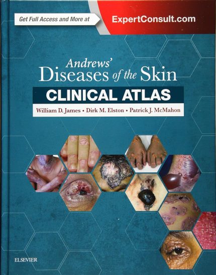Andrews' Diseases of the Skin Clinical Atlas (Digital Download) • A