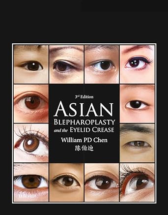 Asian Blepharoplasty and the Eyelid Crease (Digital Download) • A