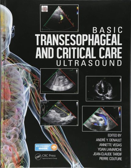 Basic Transesophageal and Critical Care Ultrasound PDF