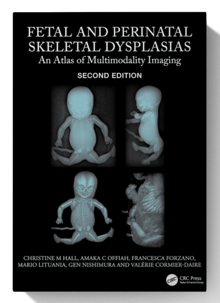 Fetal and Perinatal Skeletal Dysplasias: An Atlas of Multimodality Imaging 2nd Edition